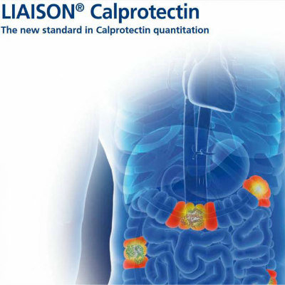 Calprotectin Test | LIAISON Calprotectin Test | Medical Equipment And ...